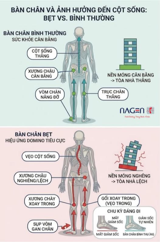 LỆCH CỘT SỐNG CHỈ TỪ VIỆC BƯỚC ĐI SAI CÁCH